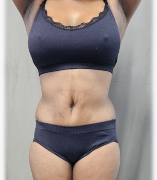 Transformation Case 5