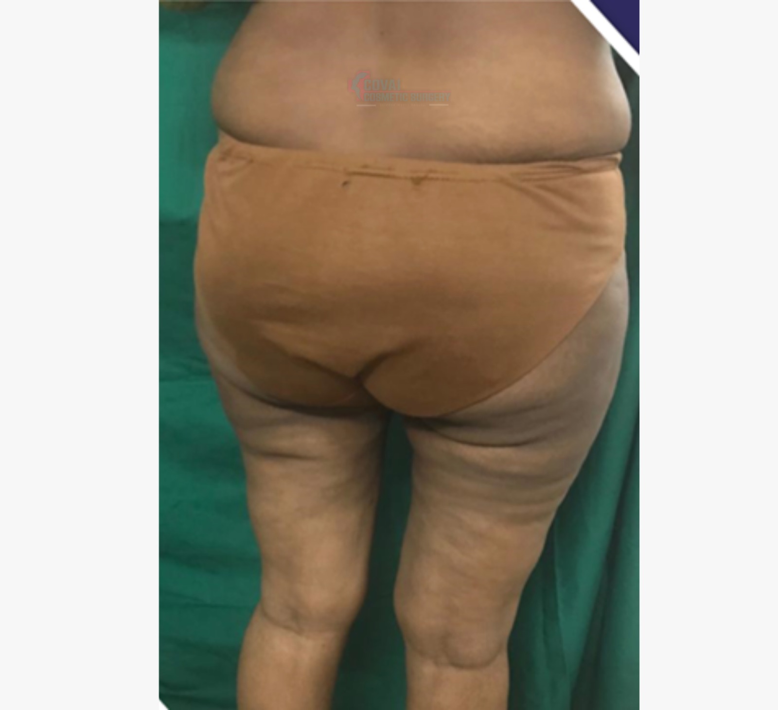 Transformation Case 7
