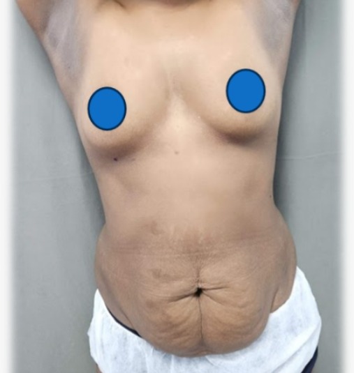 Transformation Case 5